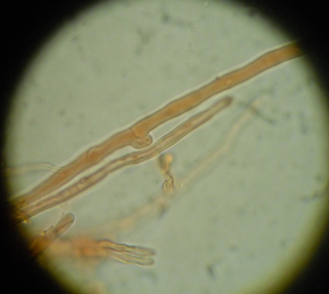 da determinare (Laeticorticium roseum)